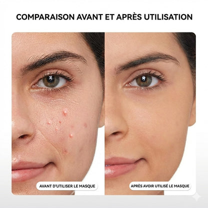 Masque Luminothérapie Led